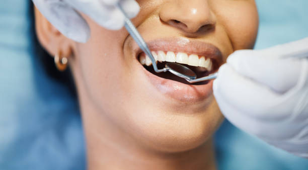 Dentist for Dental Trauma in TN