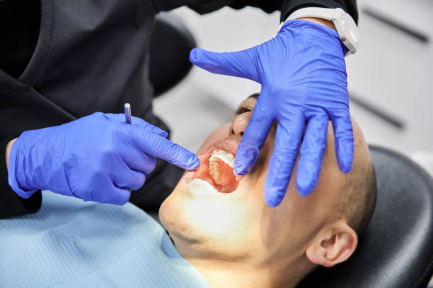 Best Knocked-Out Tooth Emergency  in Sweetwater, TN